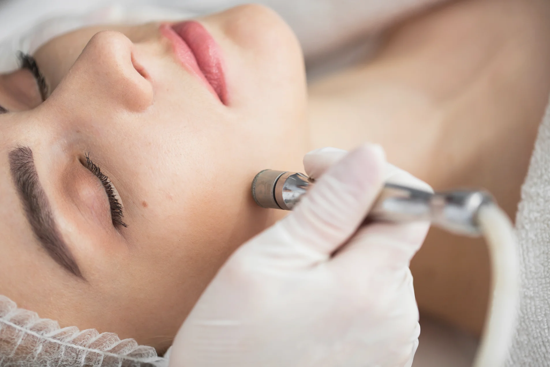 beauty-salon-landstuhl-gesichtsbehandlung-microdermabrasion