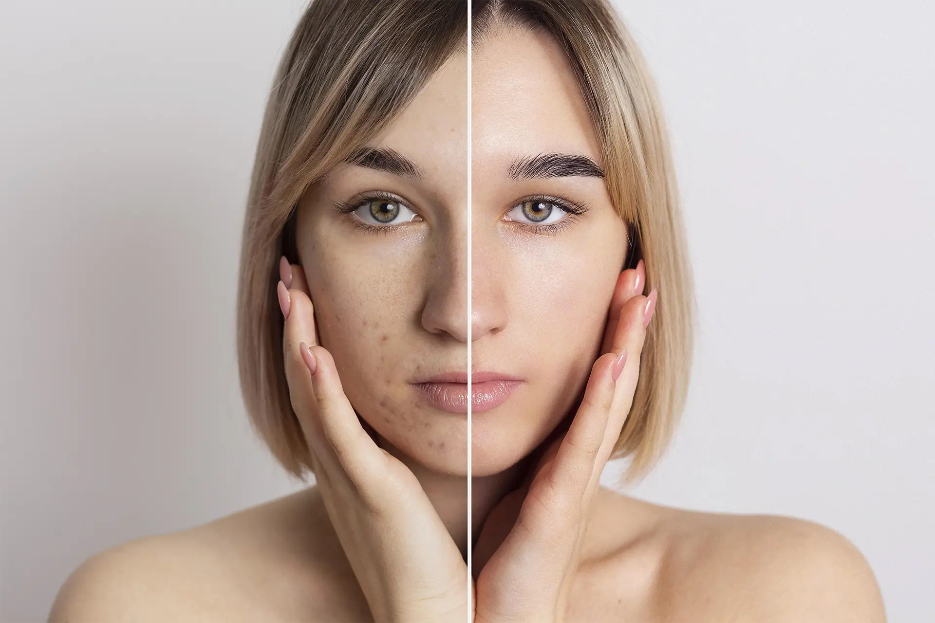 lozan-beauty-landstuhl-peeling-lifting
